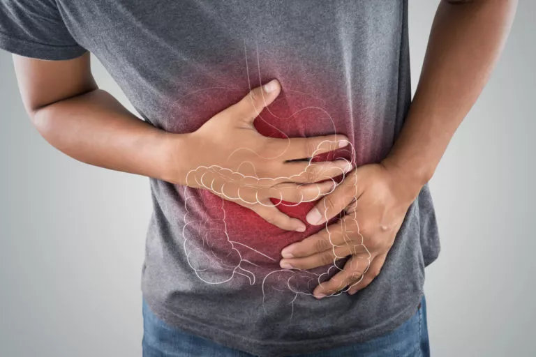 Inflammatory Bowel Disease (IBD)