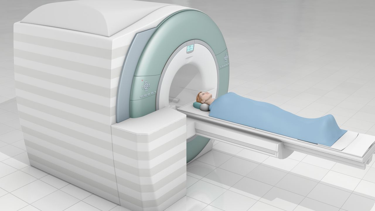 Magnetic Resonance Imaging (MRI)